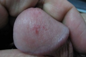 ���^��Ƥ�׵İY����F����Щ