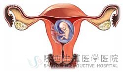 宮頸粘液異常不孕是怎么回事