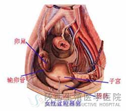 宮頸粘連會導致不孕嗎