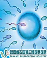 做精液檢查需注意哪些事項?