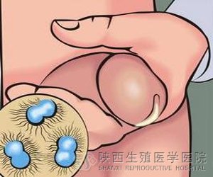 ǰ���ٲ�׃���������°���