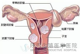 Ů�^(gu��)��ʮ��С�Ļ��ӌm��