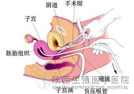 ���������oʹ���������X��